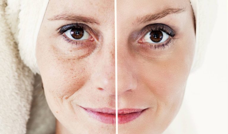 Cum să combateți îmbătrânirea pielii